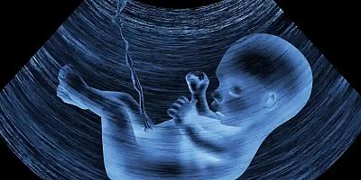 MİCROPLASTİCS REVEALED İN THE PLACENTAS OF UNBORN BABİES