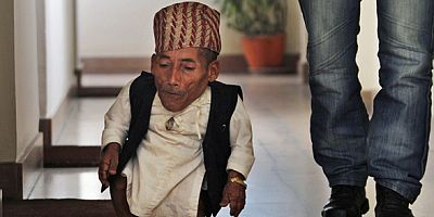 WORLD’S SHORTEST MAN WHO COULD WALK DİES AGED 27